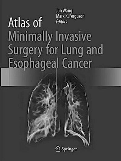 Atlas of Minimally Invasive Surgery for Lung and Esophageal Cancer