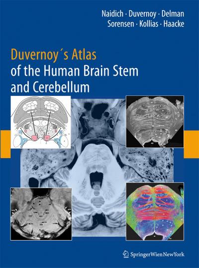 Duvernoy’s Atlas of the Human Brain Stem and Cerebellum