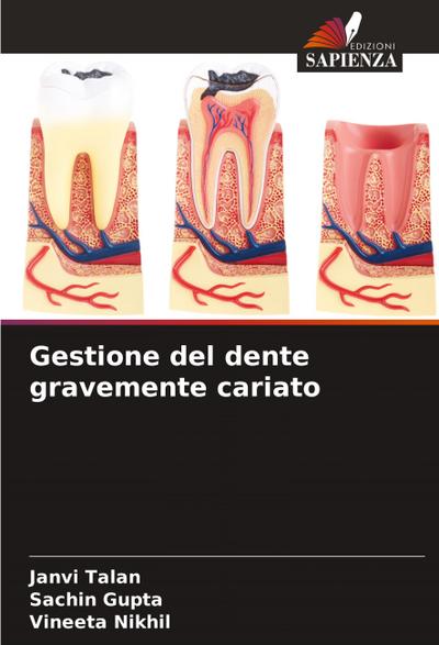 Gestione del dente gravemente cariato