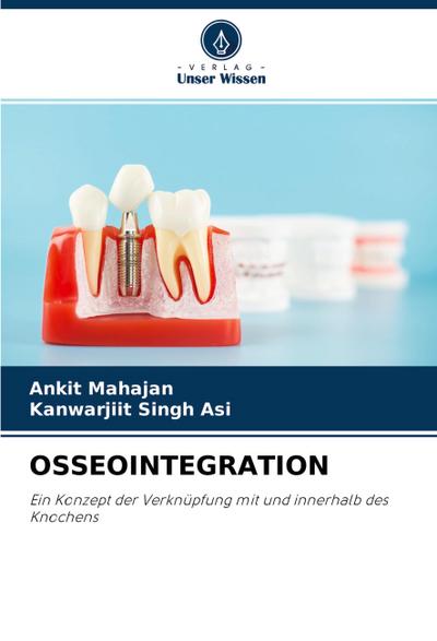 OSSEOINTEGRATION