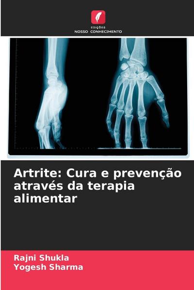 Artrite: Cura e prevenção através da terapia alimentar