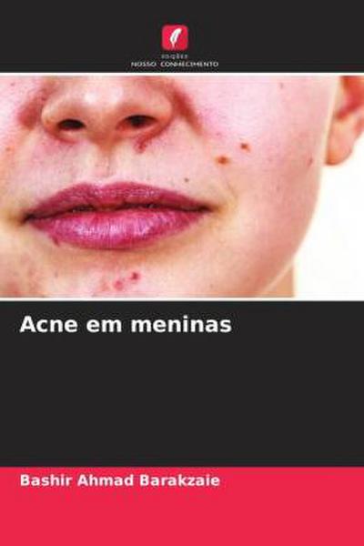 Acne em meninas