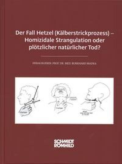 Der Fall Hetzel (Kälberstrickprozess) - Homizidale Strangulation oder plötzlicher natürlicher Tod?