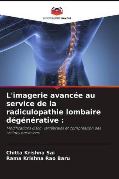 L’imagerie avancée au service de la radiculopathie lombaire dégénérative :