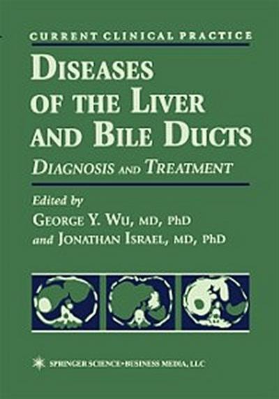 Diseases of the Liver and Bile Ducts