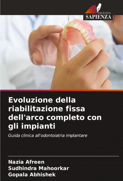 Evoluzione della riabilitazione fissa dell’arco completo con gli impianti
