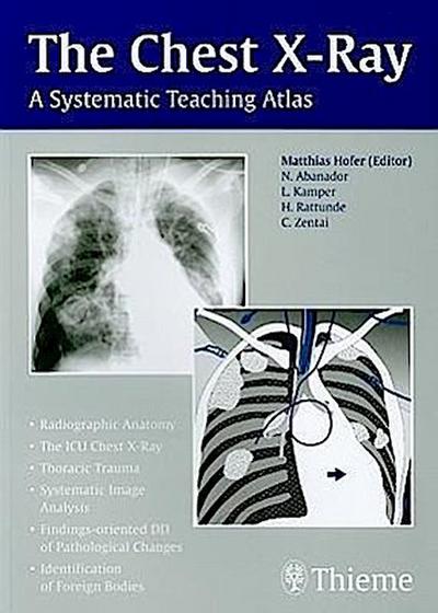 The Chest X-Ray: A Systematic Teaching Atlas - Matthias Hofer