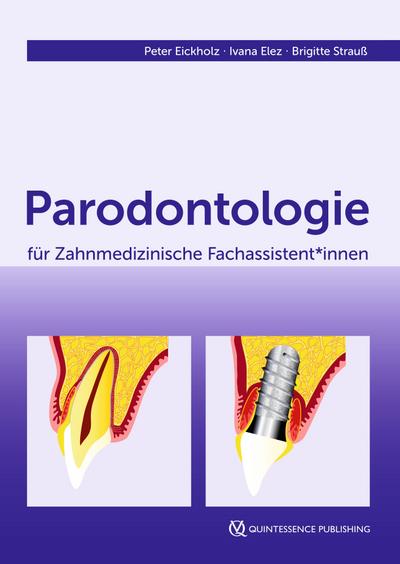 Parodontologie für Zahnmedizinische Fachassistent*innen