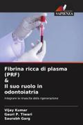 Fibrina ricca di plasma (PRF) & Il suo ruolo in odontoiatria