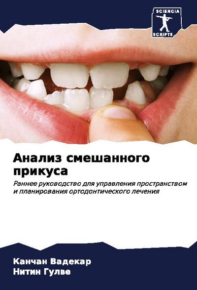Analiz smeshannogo prikusa