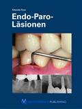 Endo-Paro-Läsionen