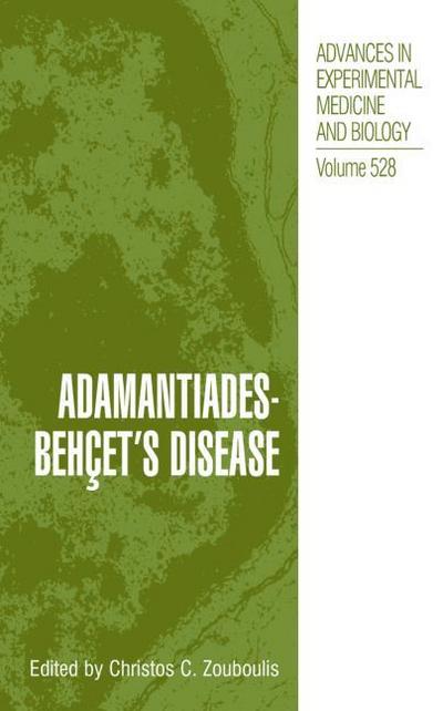 Adamantiades-Behcet’s Disease