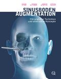 Sinusbodenaugmentation von Tiziano Testori | Ebook
