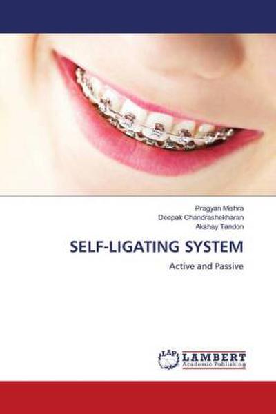 SELF-LIGATING SYSTEM