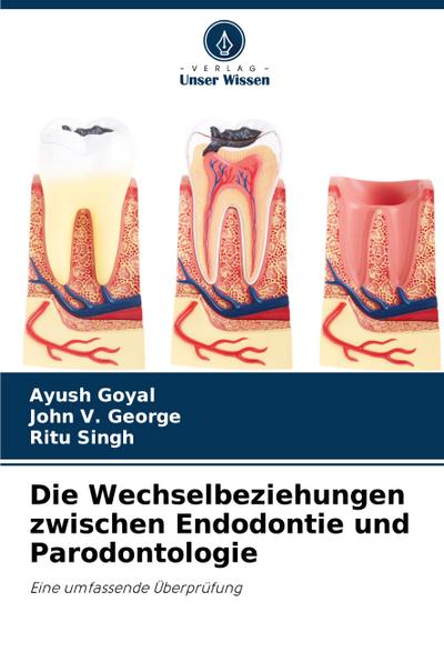 Die Wechselbeziehungen zwischen Endodontie und Parodontologie