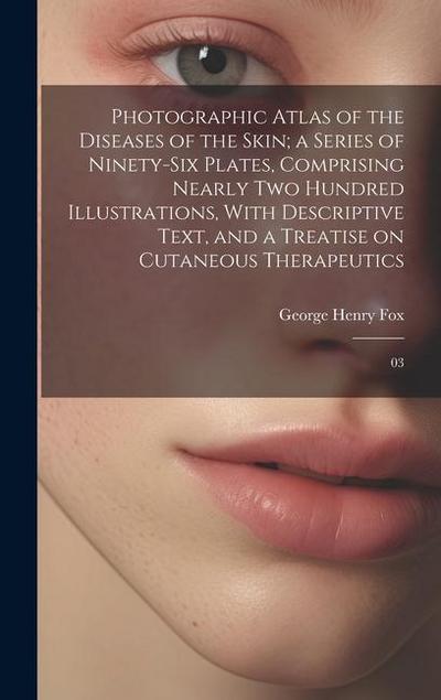 Photographic Atlas of the Diseases of the Skin; a Series of Ninety-six Plates, Comprising Nearly two Hundred Illustrations, With Descriptive Text, and