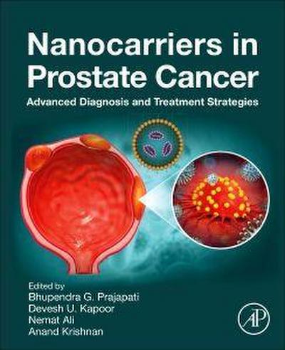 Nanocarriers in Prostate Cancer