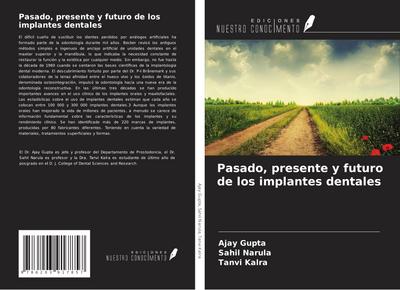 Pasado, presente y futuro de los implantes dentales