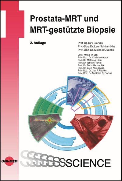 Prostata-MRT und MRT-gestützte Biopsie