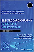 Electrocardiography in Ischemic Heart Disease