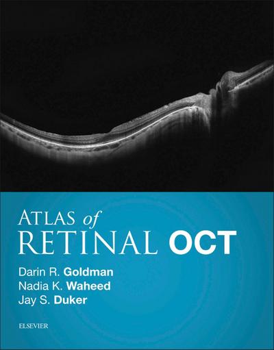 Atlas of Retinal OCT E-Book