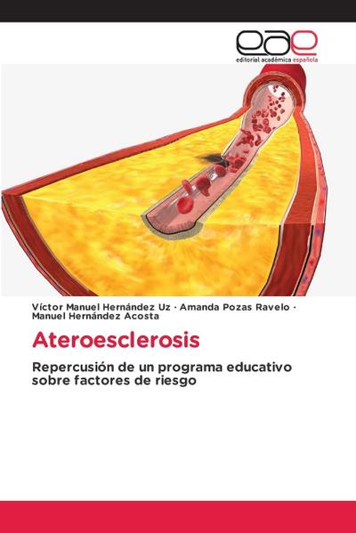 Ateroesclerosis