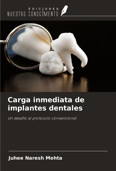 Carga inmediata de implantes dentales