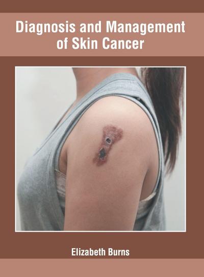 Diagnosis and Management of Skin Cancer