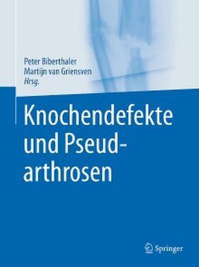 Knochendefekte und Pseudarthrosen