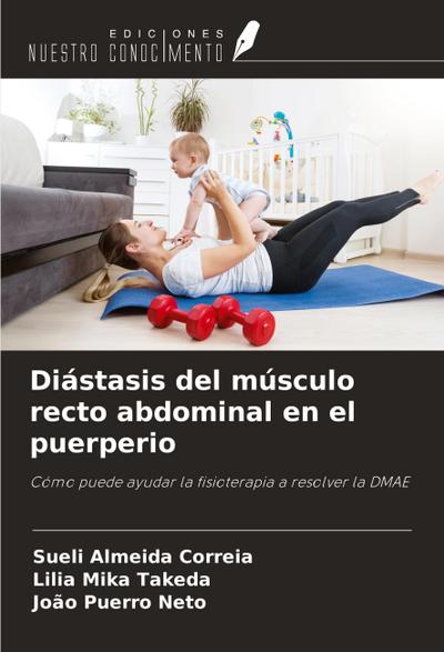 Diástasis del músculo recto abdominal en el puerperio