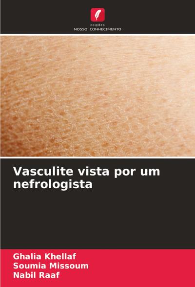 Vasculite vista por um nefrologista