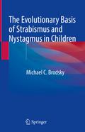 The Evolutionary Basis of Strabismus and Nystagmus