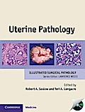 Uterine Pathology