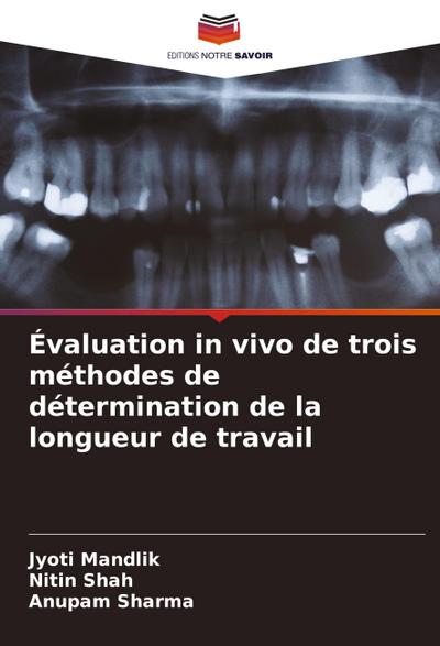 Évaluation in vivo de trois méthodes de détermination de la longueur de travail