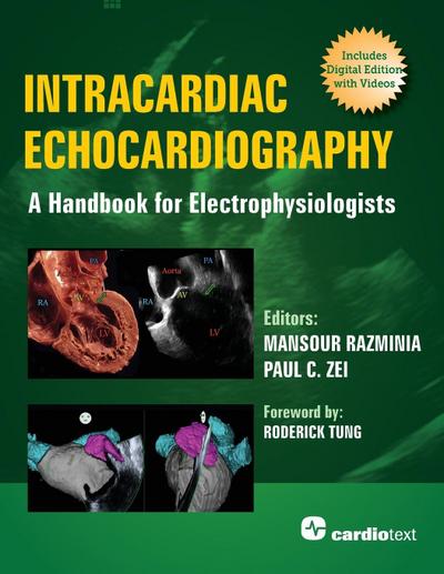 Intracardiac Echocardiography