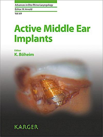Active Middle Ear Implants