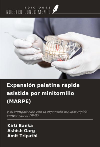 Expansión palatina rápida asistida por minitornillo (MARPE)