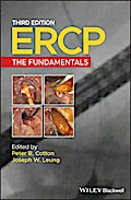 ERCP