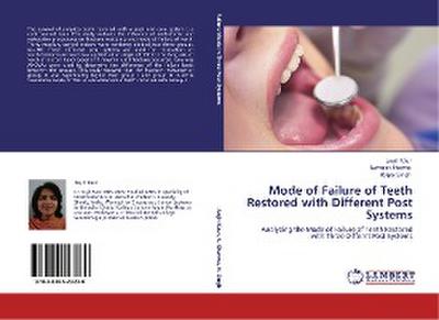 Mode of Failure of Teeth Restored with Different Post Systems