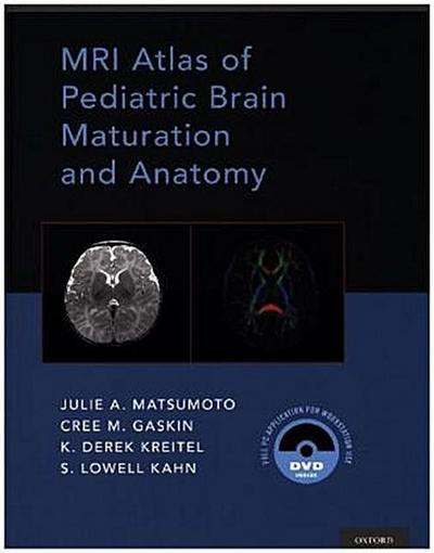 MRI Atlas of Pediatric Brain Maturation and Anatomy