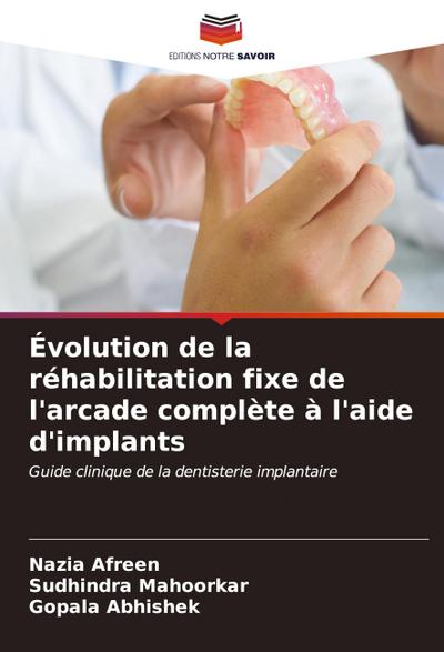 Évolution de la réhabilitation fixe de l’arcade complète à l’aide d’implants