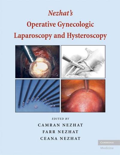 Nezhat’s Operative Gynecologic Laparoscopy and Hysteroscopy