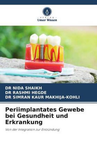 Periimplantates Gewebe bei Gesundheit und Erkrankung