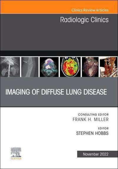 Imaging of Diffuse Lung Disease, an Issue of Radiologic Clinics of North America