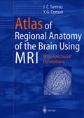 Atlas of Regional Anatomy of the Brain Using MRI