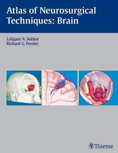 Atlas of Neurosurgical Techniques, Brain