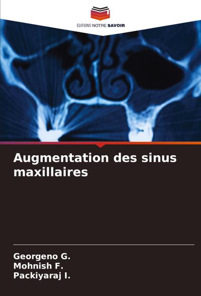 Augmentation des sinus maxillaires