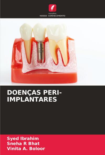 DOENÇAS PERI-IMPLANTARES