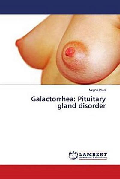 Galactorrhea: Pituitary gland disorder