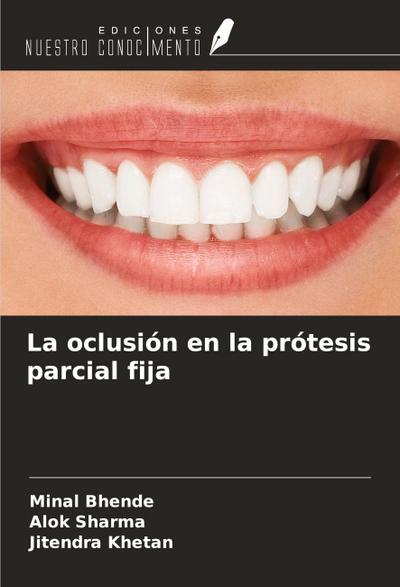 La oclusión en la prótesis parcial fija